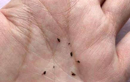 一個月小貓爪子有毒嗎